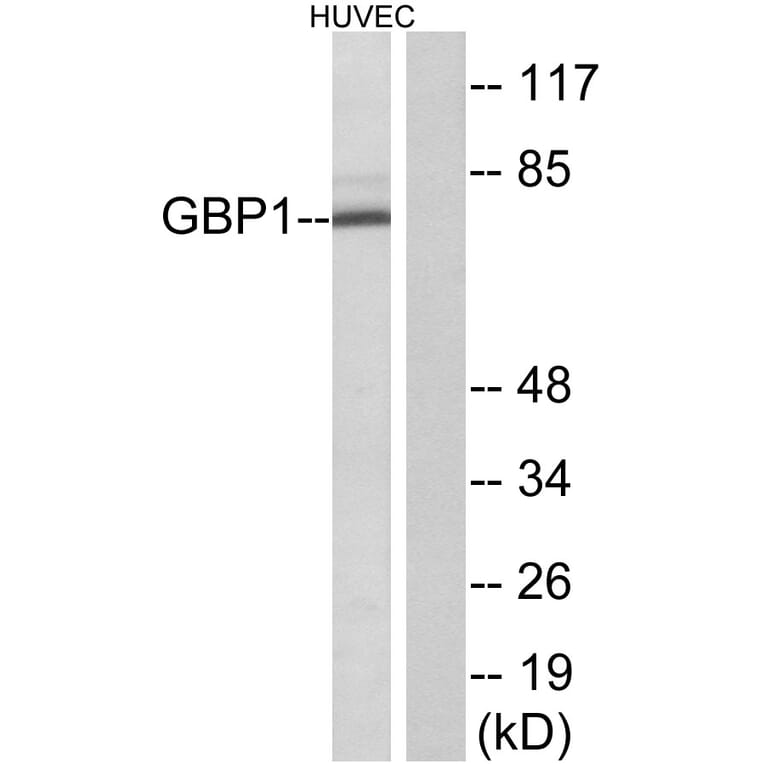 Western Blot - Anti-GBP1 Antibody (C12390) - Antibodies.com