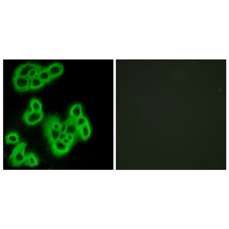 Immunofluorescence - Anti-FPR1 Antibody (G102) - Antibodies.com
