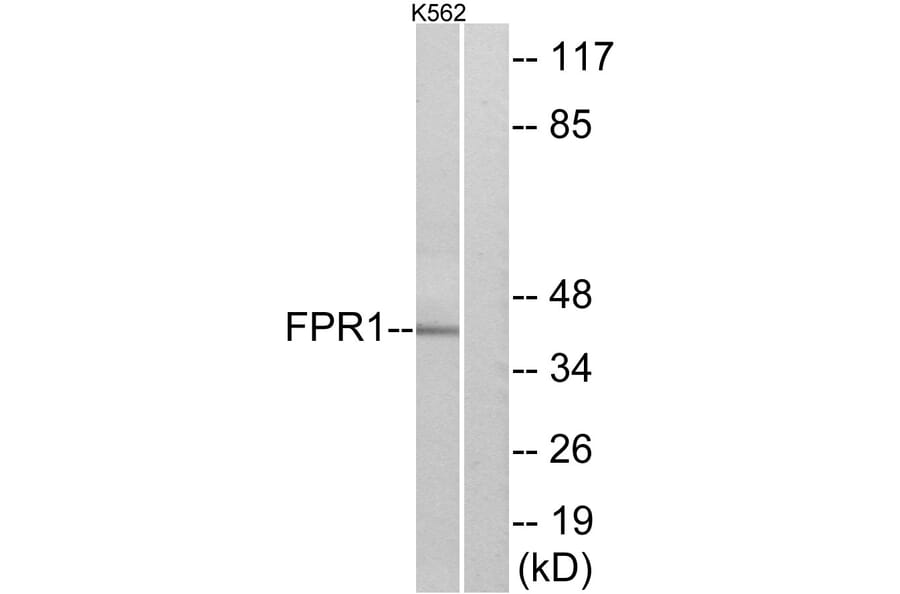 Western Blot - Anti-FPR1 Antibody (G102) - Antibodies.com
