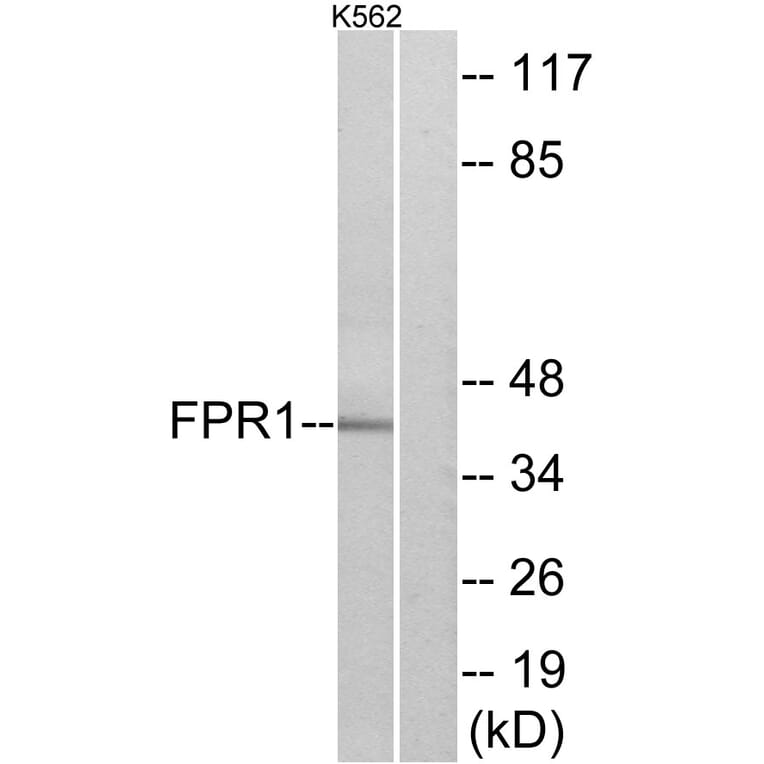 Western Blot - Anti-FPR1 Antibody (G102) - Antibodies.com