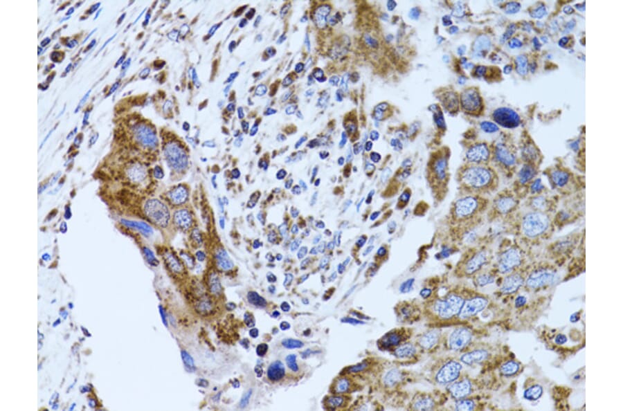 Anti-FABP4 Antibody (A12560) | Antibodies.com