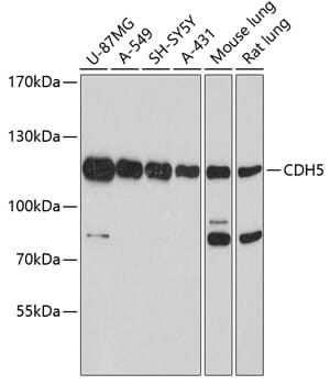 Anti-CDH5 Antibody (A11187) | Antibodies.com