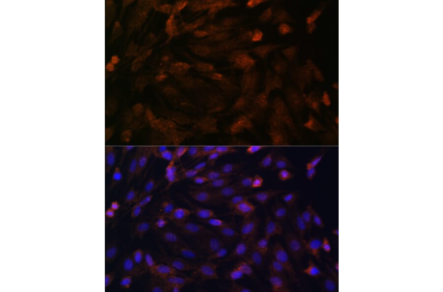 Anti-PTCH1 Antibody (A11198) | Antibodies.com