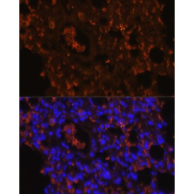 Anti-TLR2 Antibody (A80531) | Antibodies.com