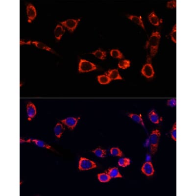 Anti-mTOR Antibody (A80511) | Antibodies.com