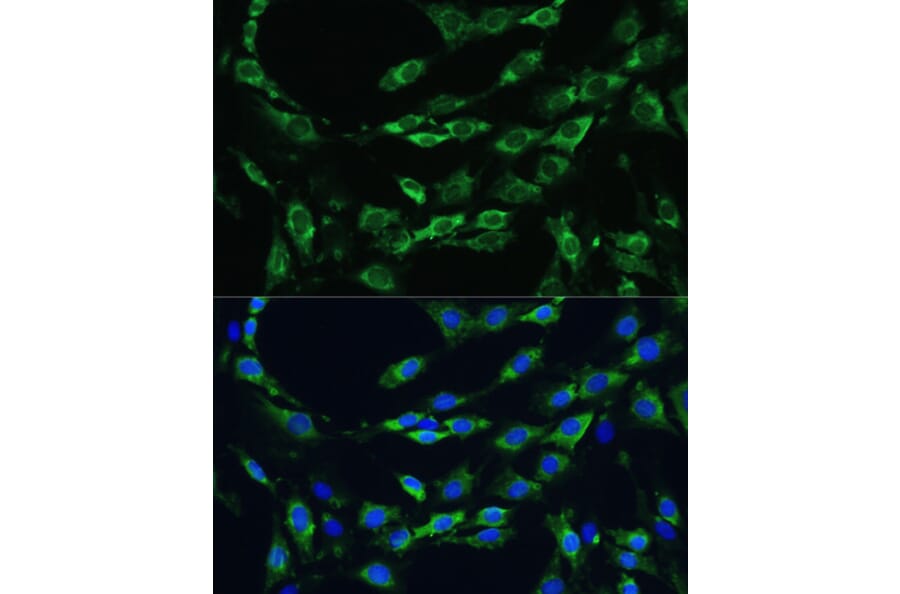 Anti-APOB Antibody (A13429) | Antibodies.com