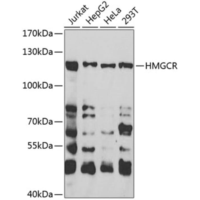 hmgcr antibody