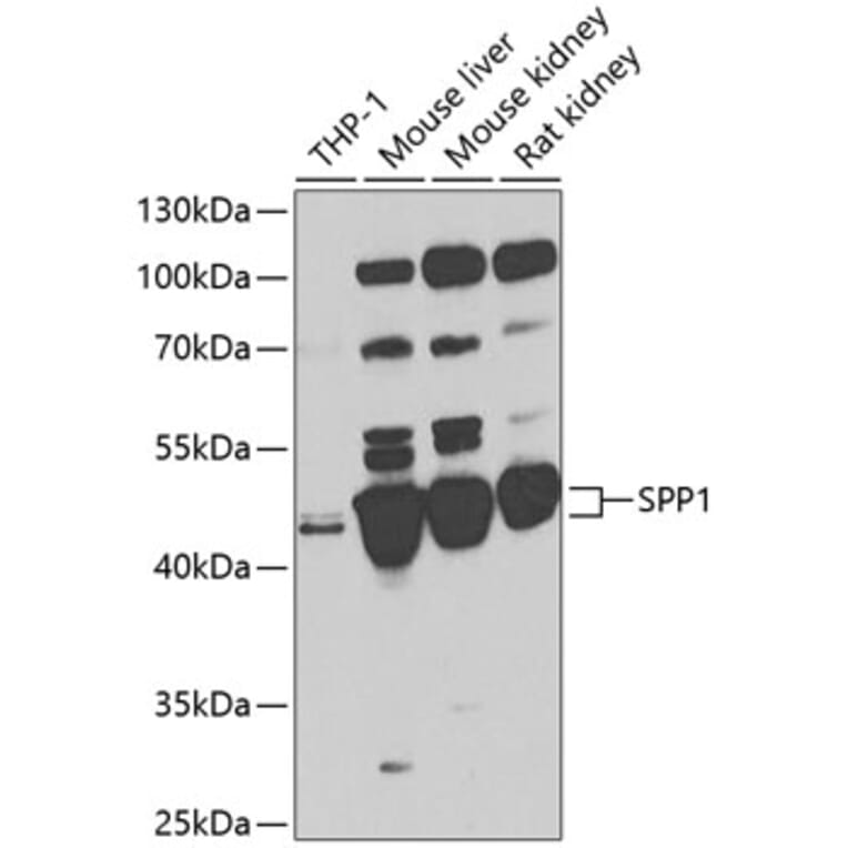 Anti-SPP1 Antibody (A87648) | Antibodies.com