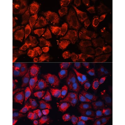 Anti-CASP3 Antibody (A13916) | Antibodies.com