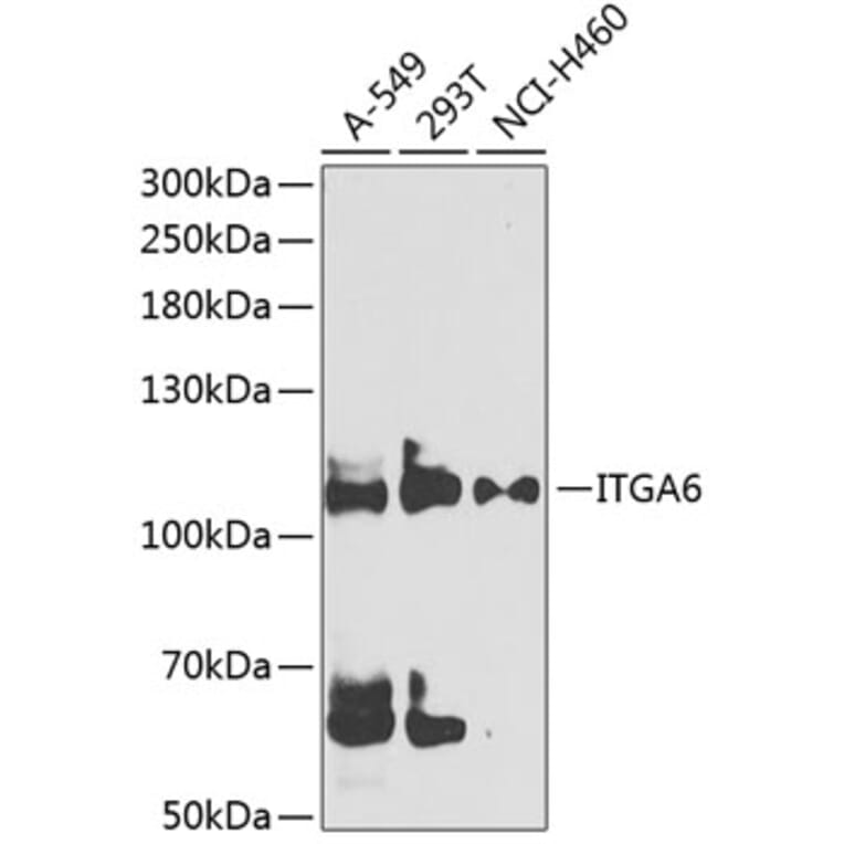 Anti-ITGA6 Antibody (A9166) | Antibodies.com