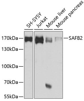 Anti-SAFB2 Antibody (A14550) | Antibodies.com