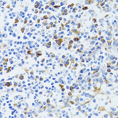 Anti-CD63 Antibody (A9694) | Antibodies.com