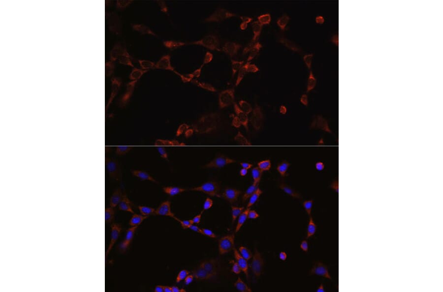 Anti-NLRP3 Antibody (A14882) | Antibodies.com