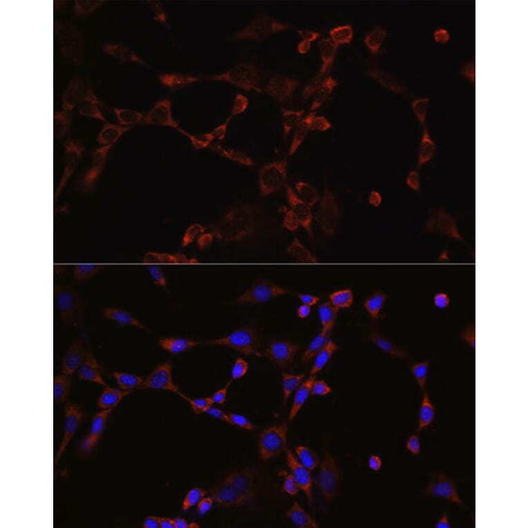 Anti-NLRP3 Antibody (A14882) | Antibodies.com