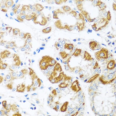 Anti-CCL2 Antibody (A12099) | Antibodies.com