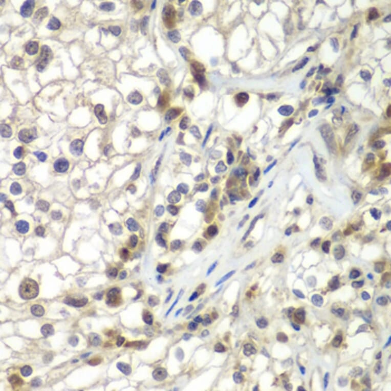 Anti Aspscr1 Antibody A Antibodies Com