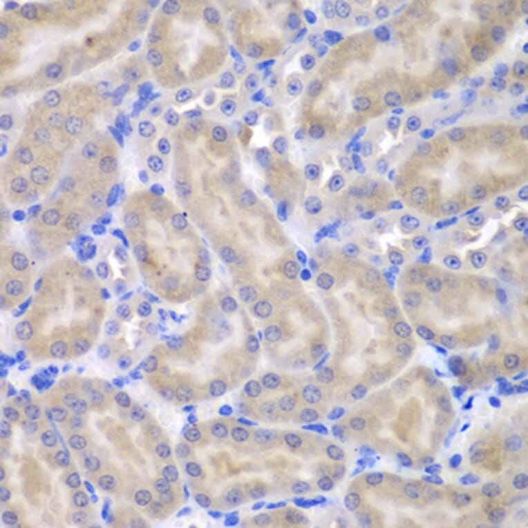 Anti Aspscr1 Antibody A Antibodies Com