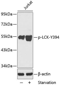 Anti-LCK (phospho Y394) Antibody (A12463) | Antibodies.com