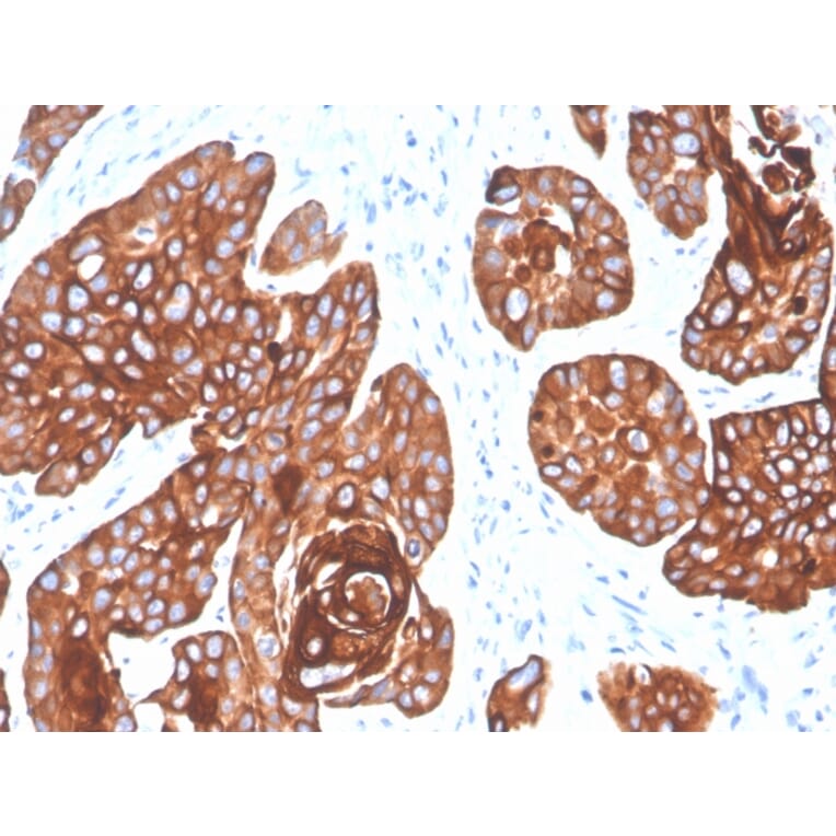 Anti Cytokeratin 5 6 Antibody Krt5 6 4866