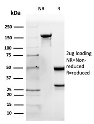 Anti-Apolipoprotein B Antibody [APOB/4335] (A277650) | Antibodies.com