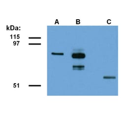 Western Blot - Anti-ABRA1 Antibody (A86190) - Antibodies.com