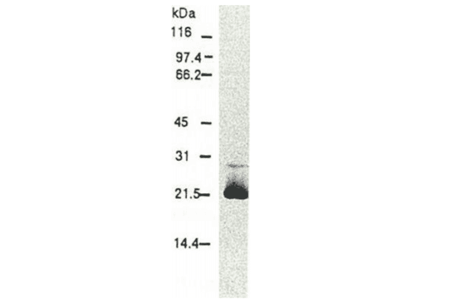 AntiHepatitis C Virus Core Antigen Anticuerpo [H629] (A330)