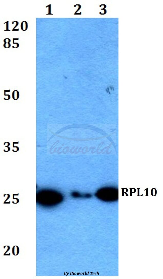 Anti-RPL10 (F34) Antibody (A26356) | Antibodies.com