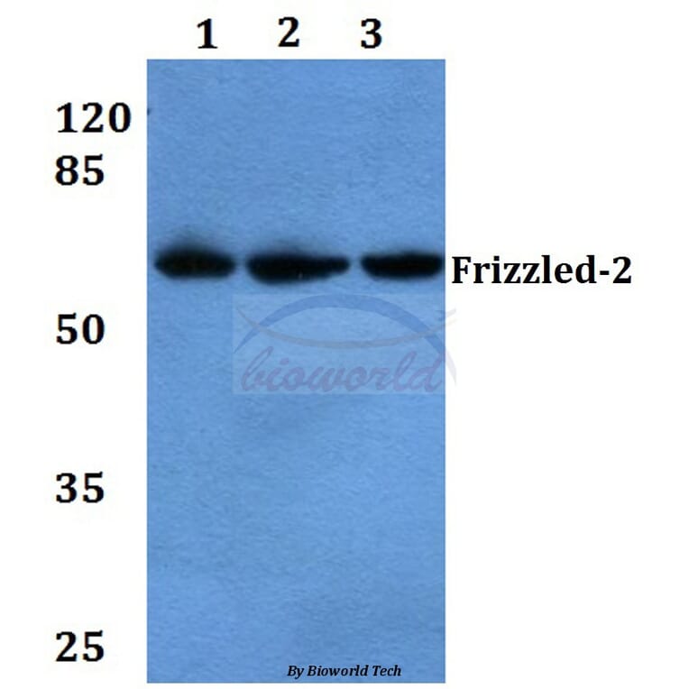 Anti Frizzled 2 E240 Antibody 6747 Antibodies Com Anti Frizzled 2 E240 Antibody 6747 Antibodies Com