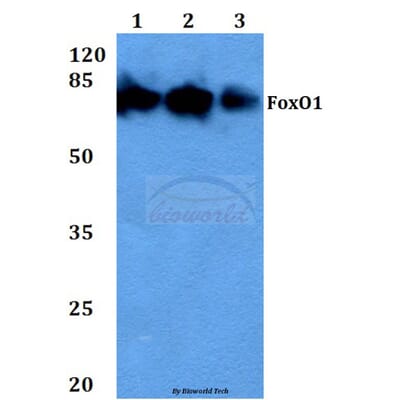 Anti Fkhr Foxo1 F313 Antibody 6997 Antibodies Com