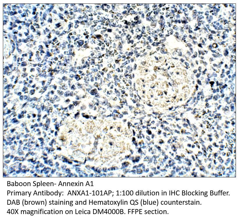 AntiAnnexin A1 Antibody (A54112)