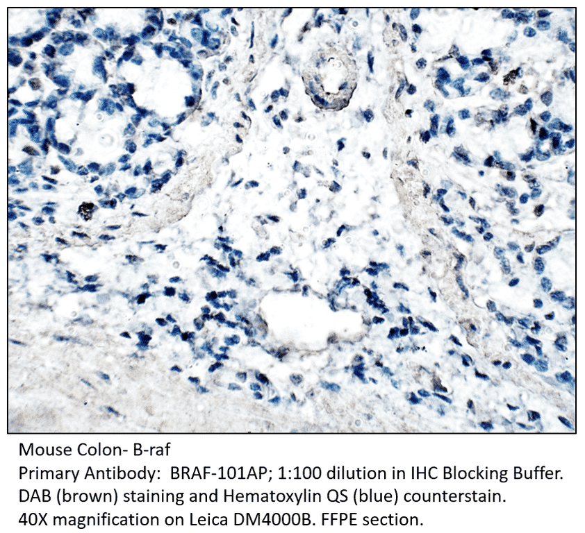 Anti-B-raf Antibody (A54826) | Antibodies.com