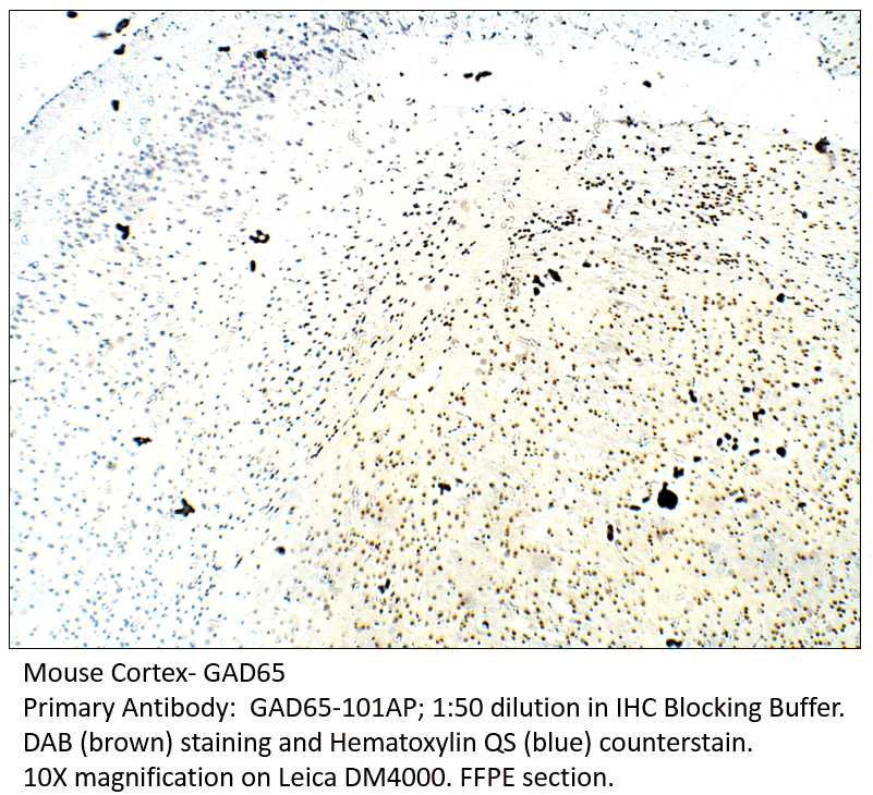 AntiGAD65 Antibody (A54677)