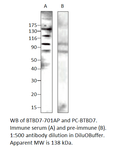 BTB/POZ domaincontaining protein 7 Positive Control (A56459)