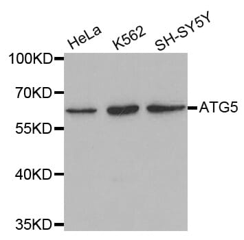 Anti-ATG5 Antibody (A38903) | Antibodies.com