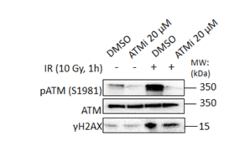 Western Blot - Anti-ATM (phospho Ser1981) Antibody (A10862) - Antibodies.com Review