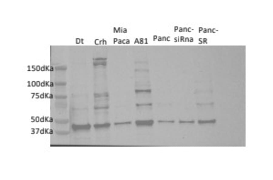 Western Blot - Anti HFE antibody (A11436) - Antibodies.com Review