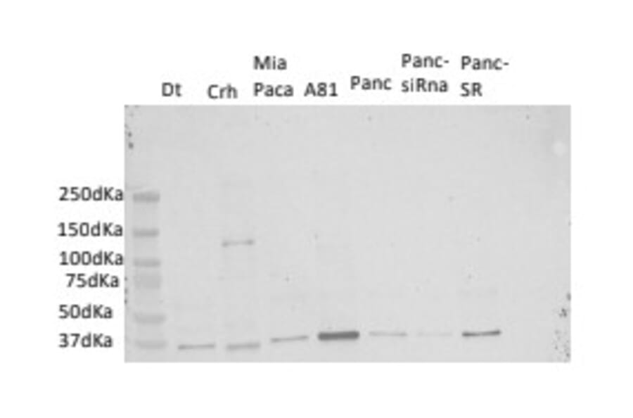 Western Blot - Anti-B2M Antibody (A29785) - Antibodies.com Review