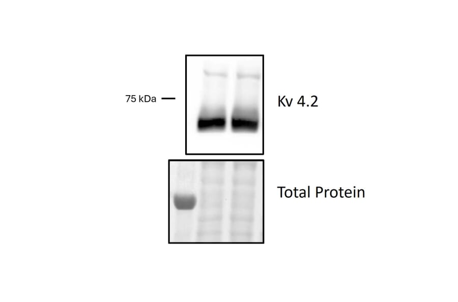 Western Blot - Anti-KV4.2 Antibody (A31146) - Antibodies.com Review