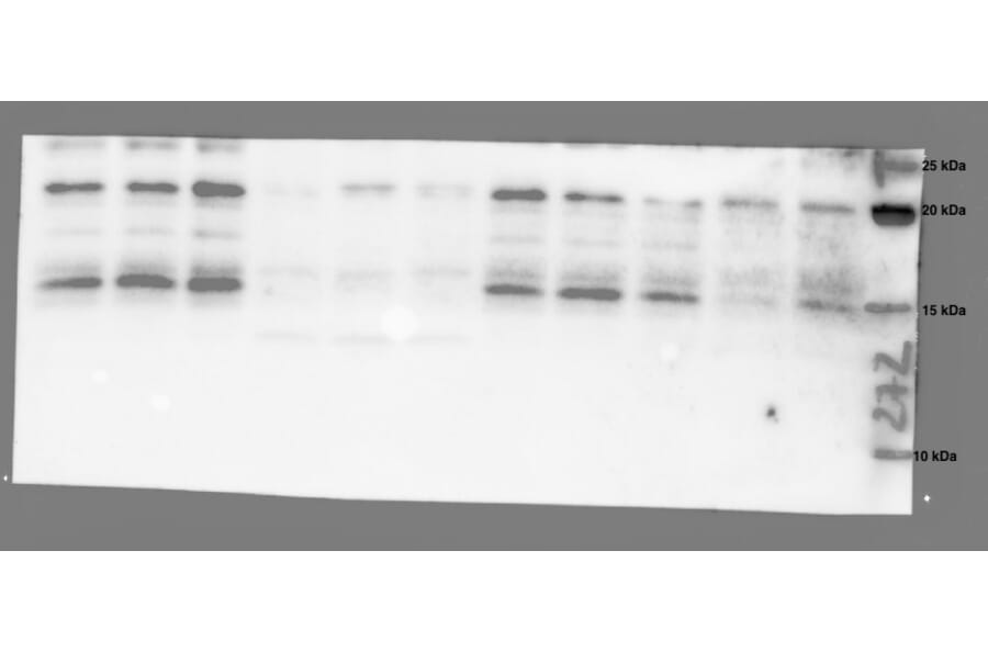 Western Blot - Anti-GHRL Antibody (A43994) antibodies.com Review - Skeletal muscle (gastrocnemius, diaphragm, soleus), heart, Pancreas (healthy and tumor) antibodies.com Review