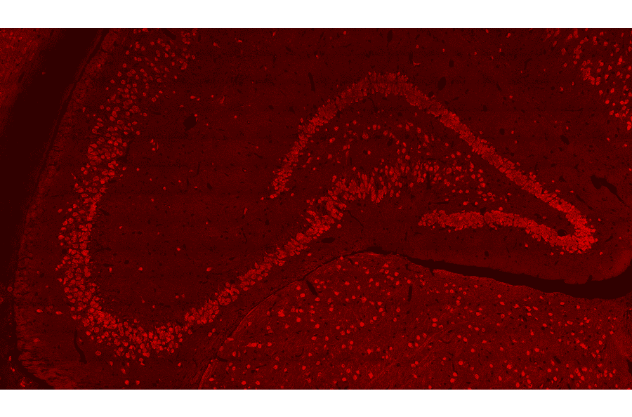 Hippocampus NeuN staining using Anti-NeuN Antibody (A85403) - Antibodies.com Review