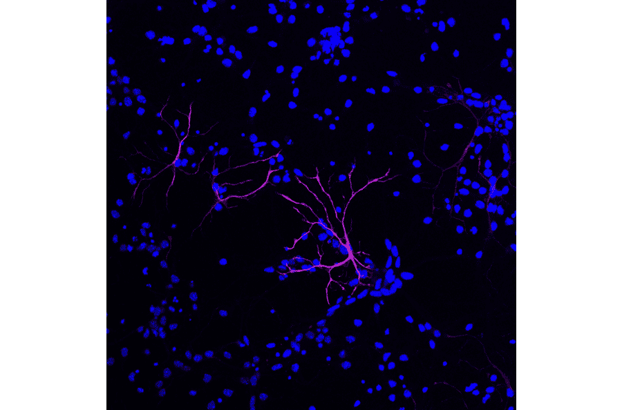 Immunofluorescence - GFAP antibody (A85419) - - Antibodies.com Review