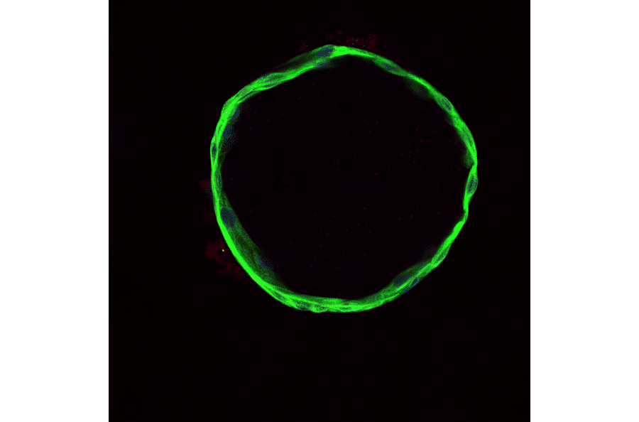 Immunofluorescence image showing merged channels with CK19