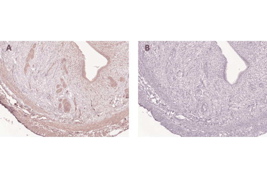 Immunohistochemistry - Anti-APLN Antibody (A98286) - Antibodies.com Review