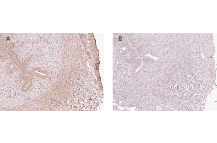 Immunohistochemistry - Anti-APLN Antibody (A98286) - antibodies.com Review