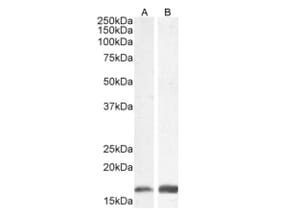 Western Blot - Anti-Iba1 Antibody (A82670) - Antibodies.com
