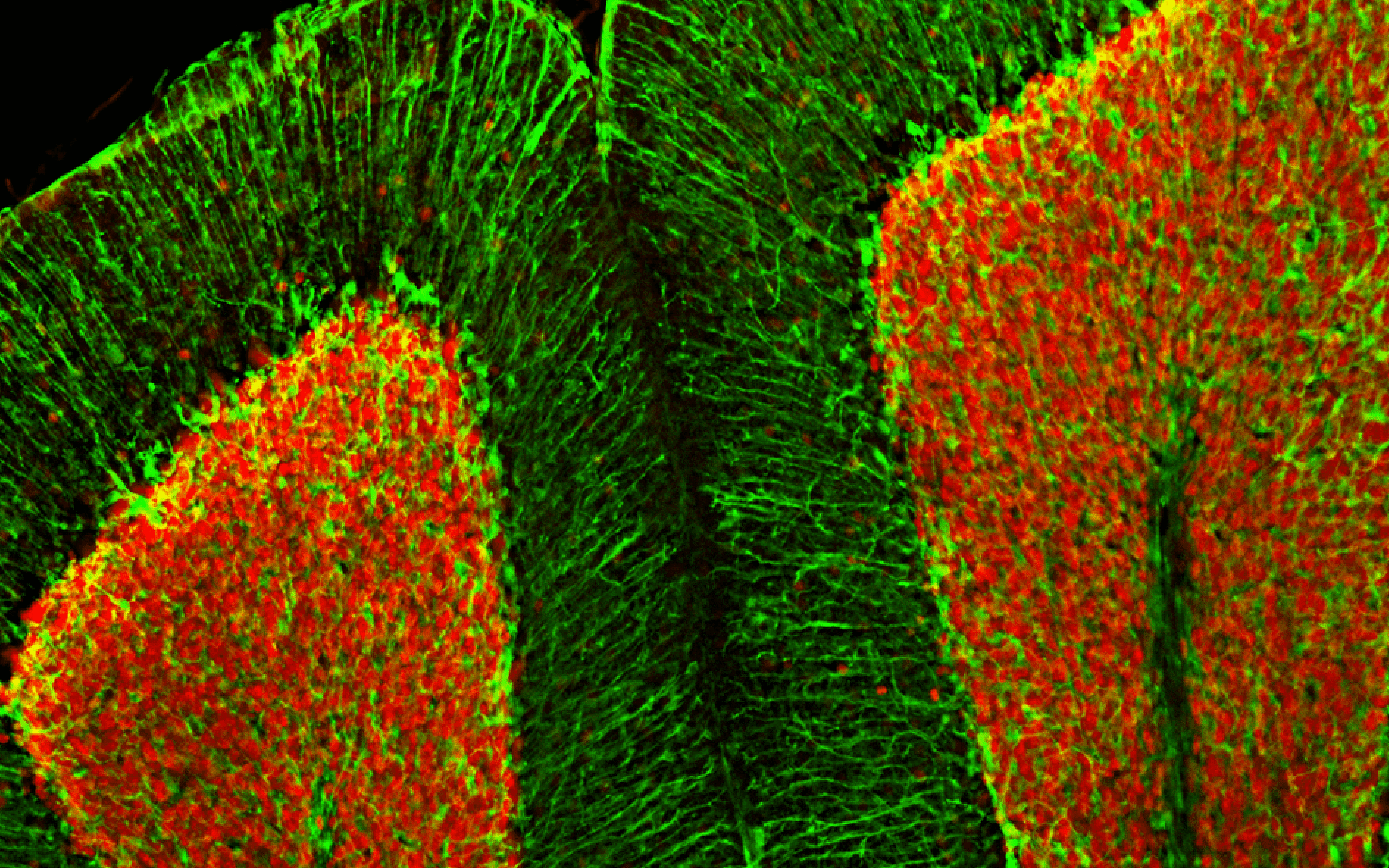 Immunofluorescence - Anti-Fox3 Antibody (A85403) - Antibodies.com