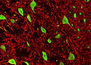 Immunofluorescence - Anti-NeuN Antibody [1B7] (A85405) - Antibodies.com