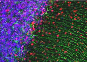 Immunofluorescence - Anti-GFAP Antibody (A85419) - Antibodies.com