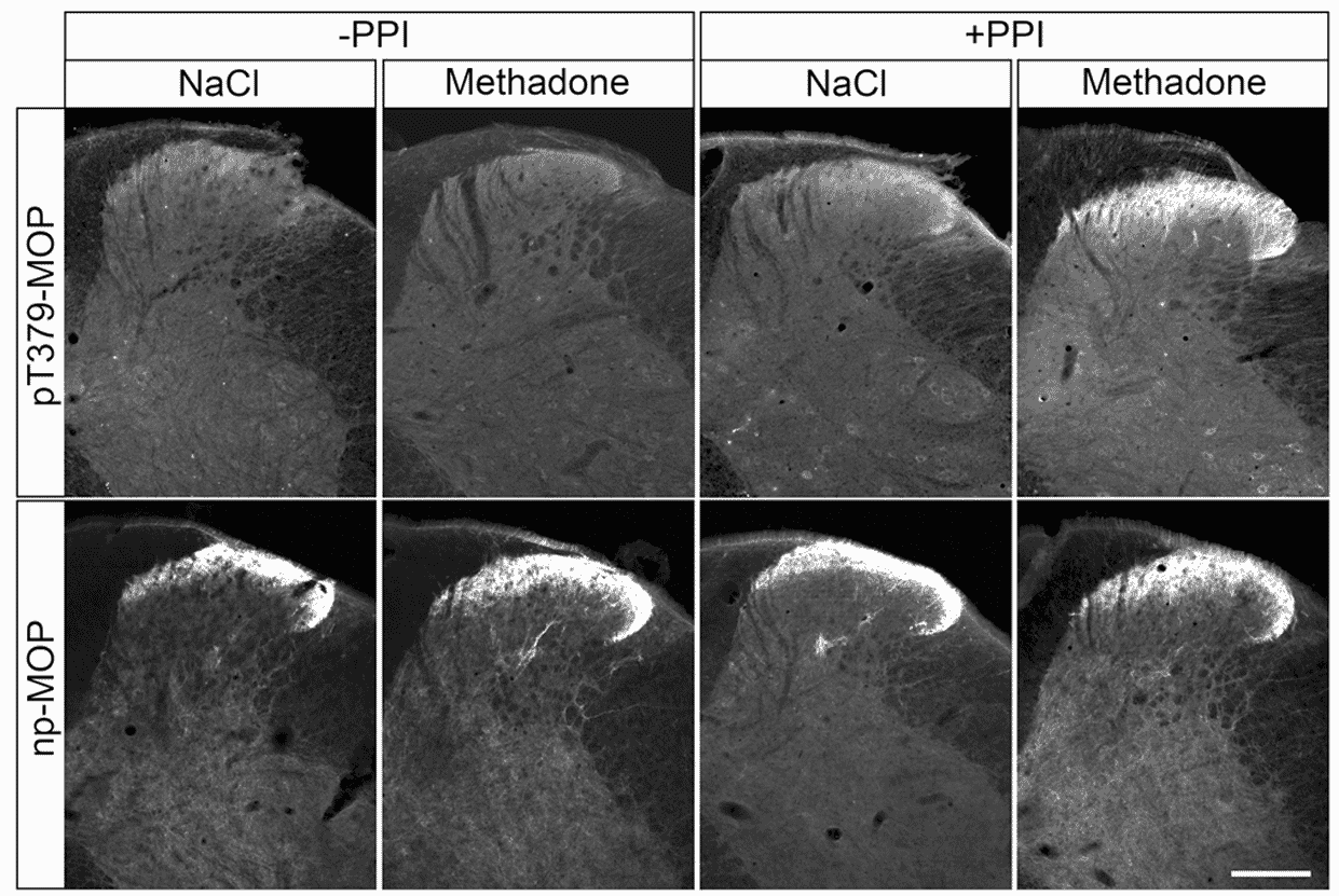 IHC of phosphorylated and non-phosphorylated mu opioid receptor with and without phosphatase inhibitors.