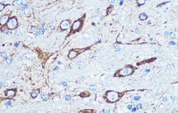 IHC of paraffin-embedded mouse brain using Anti-NMDAR1 Antibody (A15836)
